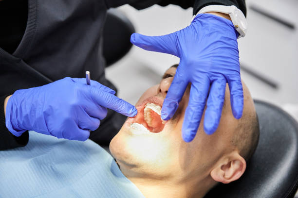 Best Weekend Emergency Dentist in Sonoma State University, CA