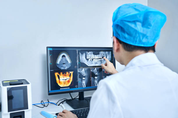Best Emergency Broken Tooth Repair in Sonoma State University, CA